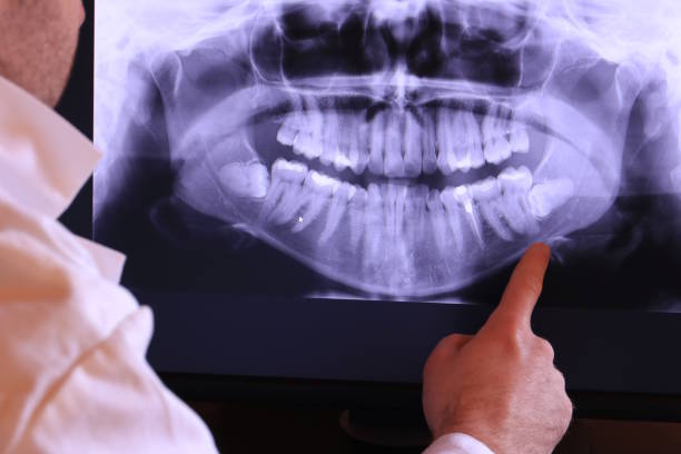 Best Emergency Denture Repair in Leipsic, OH