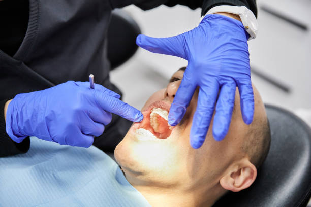 Best Emergency Dental Care for Broken or Chipped Teeth in Leipsic, OH